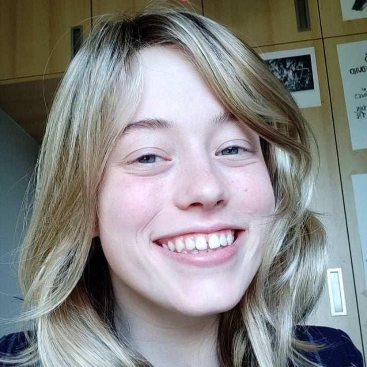 Hoe studente Christine de klik maakte om haar haarverlies door alopecia areata te aanvaarden