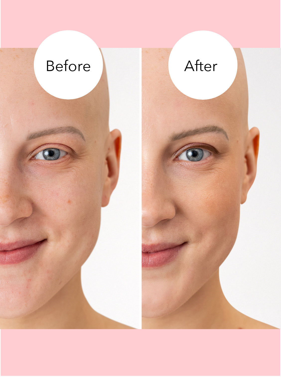 make-up kanker