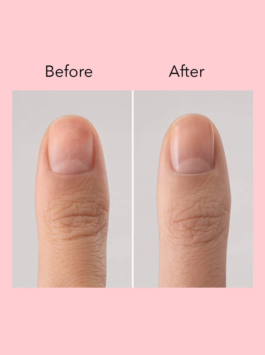 Beschermende Nagellak Basis - Même