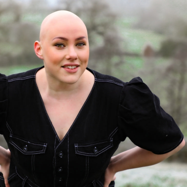 Lockdown, Instagram en Alopecia: hoe Laura haar kracht vond